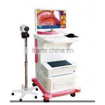 factory directly Digital electronic colposcope for hot sale