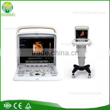 FM-580 portable cardiac ultrasound with ISO, CE certification