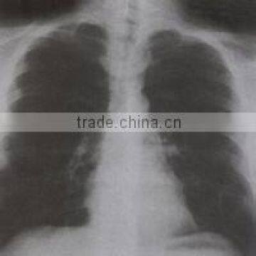 medical dry x ray films, x ray laser films, 14*17inch 35*43 cm medical dry film