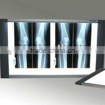 Water resistance Digital Medical Film Scanner Film Digitizer x-ray Films