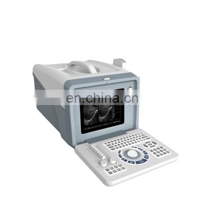 HC-A001 Hot sell  Full digital Portable ultrasound machine scanner/ ultrasound machine with Factory price