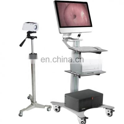 Portable Trolley Gynecology Vagina Examination Endoscope Full HD Digital Video Colposcope