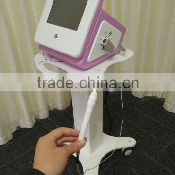 beauty machine for vascular removal spider veins removal line veins removal/ promotion