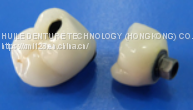 IPS e.max Porcelain Fused to Zirconia Pfz Crowns and Bridge From Ads Dental Lab