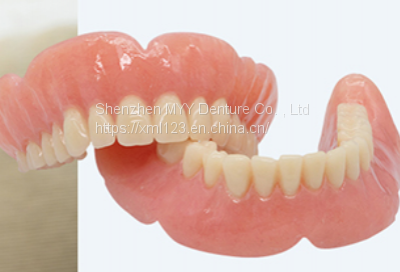 PFM Crown Denture 3D Printing Design Denture Customization