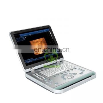 MY-A009B USG Full digital 4D Laptop Ultrasound Scanner Price Portable 4D Ultrasound Machine