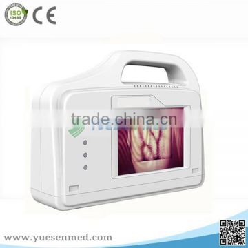 YSVV200 Good quality medical large screen portable vein viewing