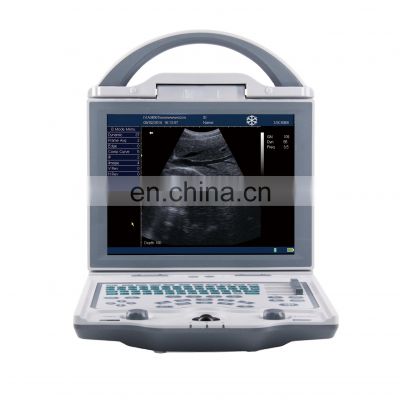 China Wholesale Supplier Full digital B mode ultrasound scanner With Certificate