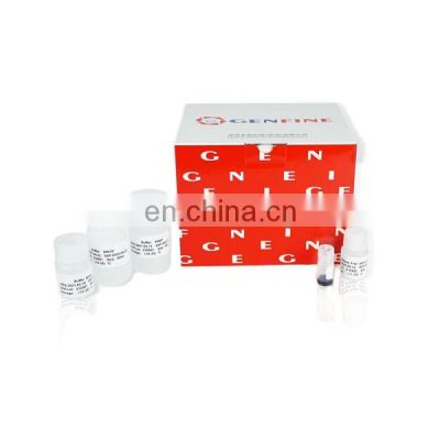 Generic Nucleic Acid Dna / Rna Extraction Kit Reagent Kit Machinery Box Ce Air 10 Boxes Online Technical Support Accept OEM