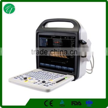 factory SUPPLY portablolor ultrasound machines/ultrasound scanner CE approval doppler ultrasound scanner