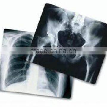 Fuji DIHL / Fuji DI-HL /14*17medical film Dry Laser Imaging X-ray Film