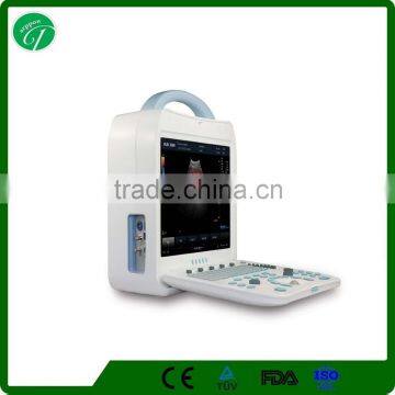 Portable Cardiac Ultrasound System Color Doppler Ultrasound