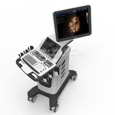 V60 Color Doppler Diagnostic Ultrasound System