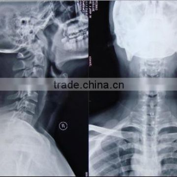 imaging camera Medical laser film made in china medical equipments not phone