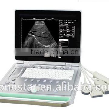C5 laptop Multi language Multi language color doppler ultrasound scanner