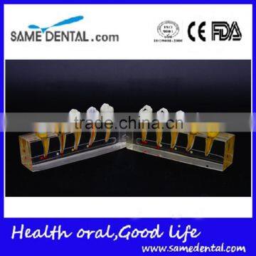 Dental endodontics disease demonstration teeth model 2 DEA-50