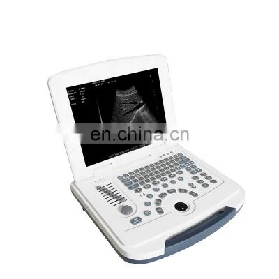 HC-A003 High Quality Full digital portable laptop ultrasound pregnancy scanner ultrasound