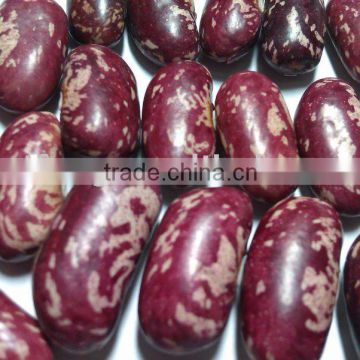 Purple Speckled Kidney Bean( 2011 crop, Heilongjiang Origin, Hps)