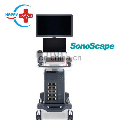 Lowest price Ultrasound machines sonoscape p15/Sonoscape ultrasound p15/Color doppler ultrasound machine