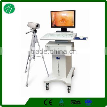 Chinese vagina examination/ digital video colposcope 9800T
